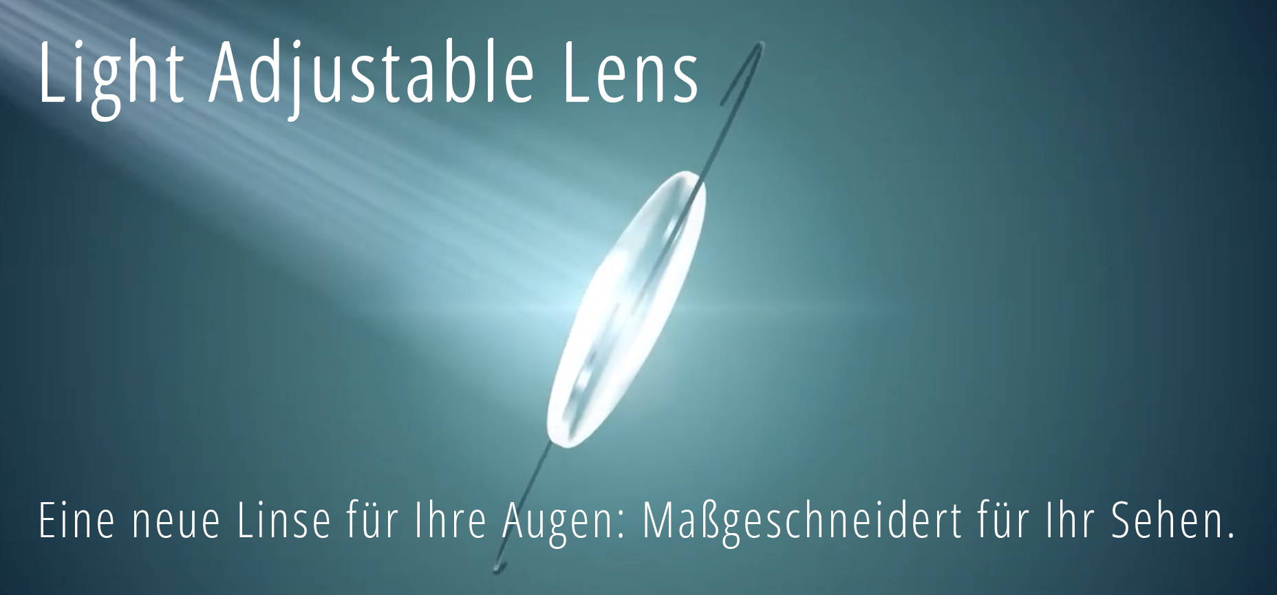 Light Adjustable Lens. Eine Kunstlinse zur individuellen Feinanpassung nach der Operation