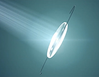 Light adjustable lens