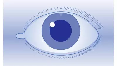 Die Hinterkammer Kunstlinse ist mit dem bloßen Auge nicht sichtbar 