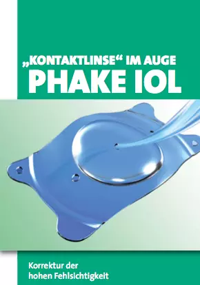 Kontaktlinse